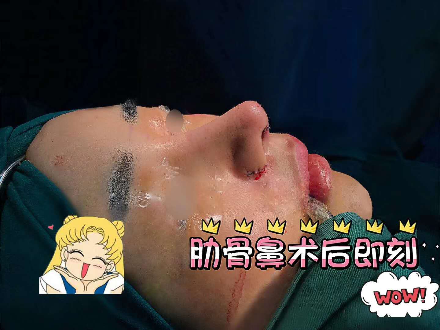 北京隆鼻專家前十名，北京隆鼻醫(yī)生排行榜