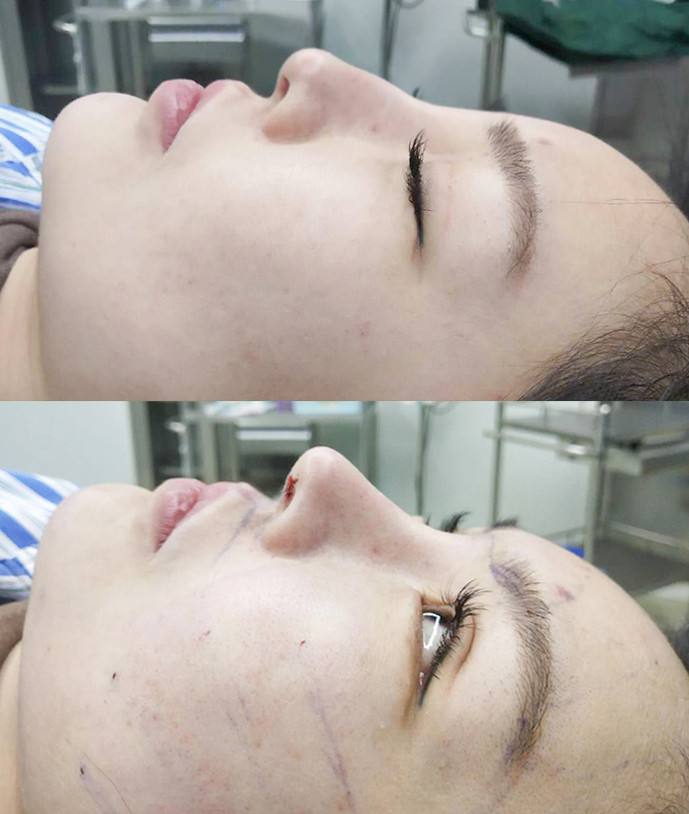 國內最好的鼻子修復專家是誰?