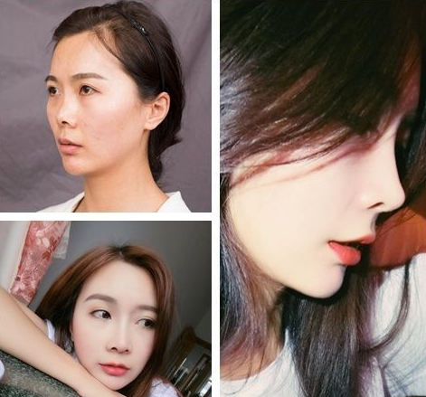 上海做鼻子最好的醫生是哪個？