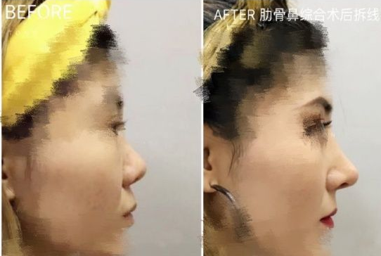 國內最厲害的鼻修復專家：范飛和戴傳昌哪個好？