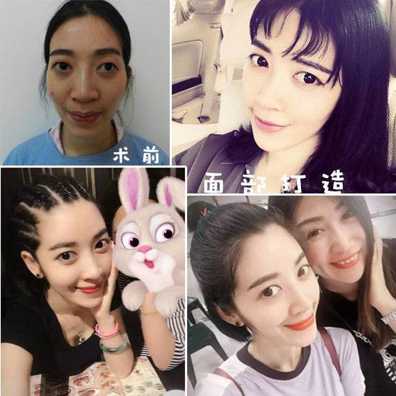 武漢哪個醫生做脂肪填充好？