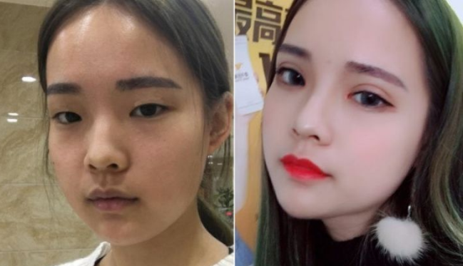 鄭州眼綜合哪里做得好？鄭州雙眼皮醫生推薦