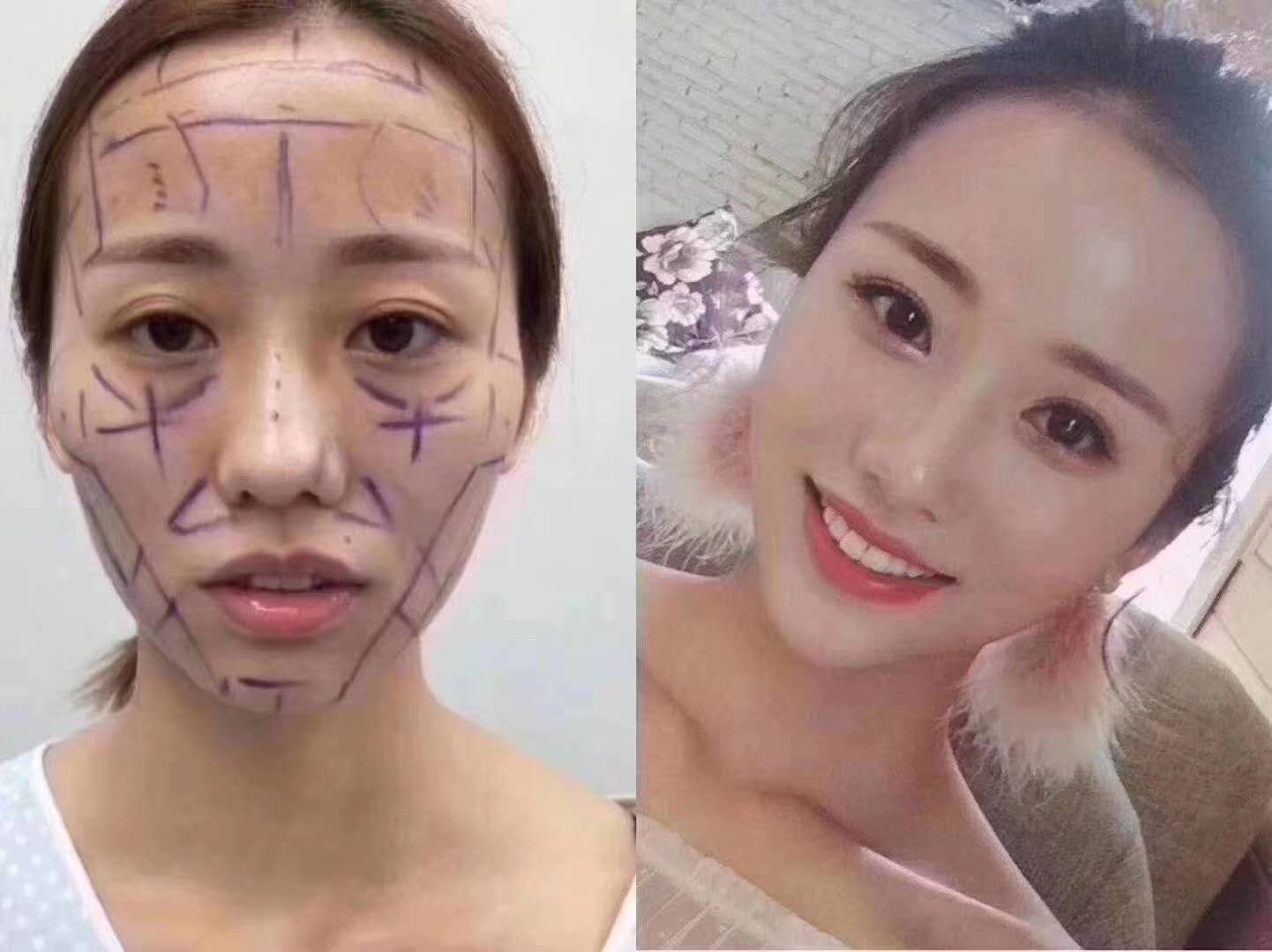 上海九院面部脂肪填充哪個醫生好？
