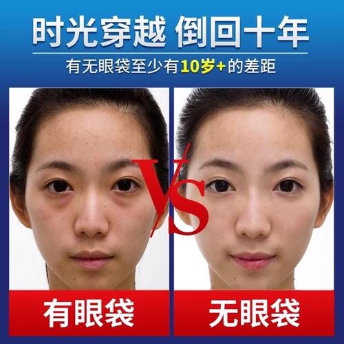 上海九院祛眼袋哪位專家技術(shù)好？