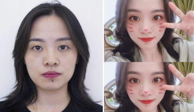 長(zhǎng)沙做雙眼皮最出名的醫(yī)生排名