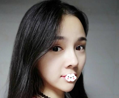 成都黃開亮和盧元剛哪個做鼻子好？
