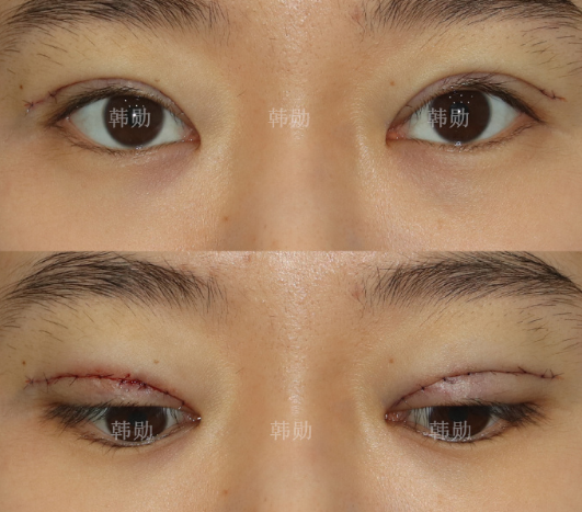 中國擅長做眼修復(fù)的醫(yī)生有哪些