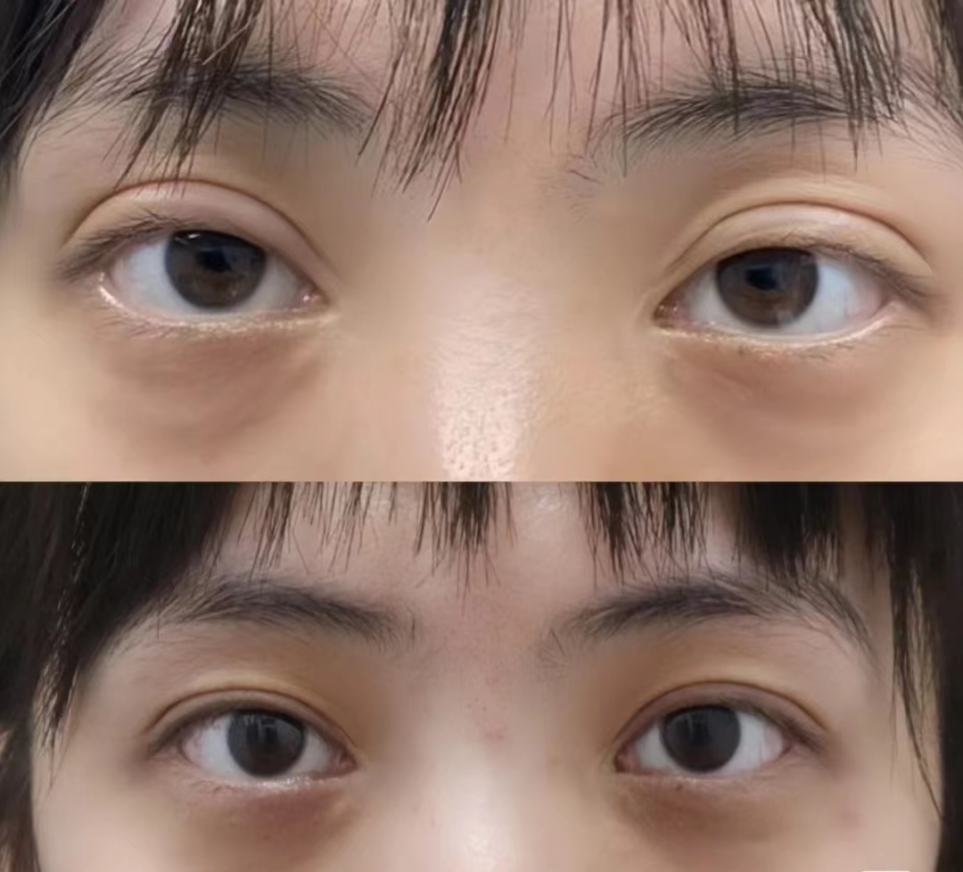 上海做眼修復(fù)最有名的醫(yī)生是哪個
