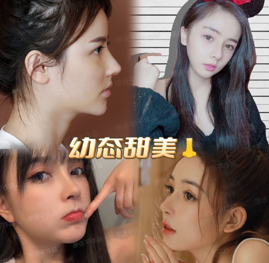 成都做鼻修復哪個醫院醫生好