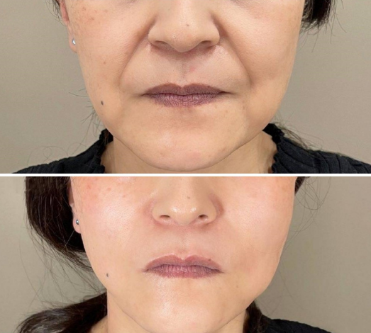 國內(nèi)做拉皮手術(shù)最有名的醫(yī)生是誰？趙延勇、金云波、謝宏彬、穆寶安、祝東升？