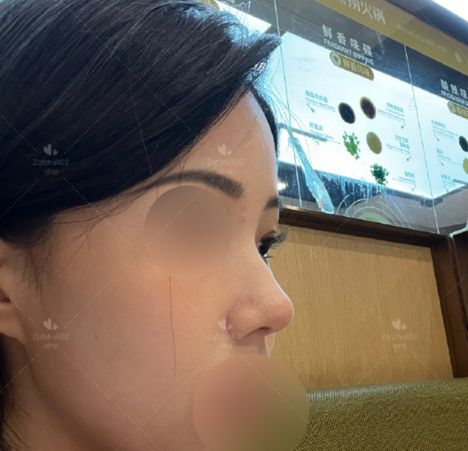 國內(nèi)鼻修復最好的醫(yī)生是哪個