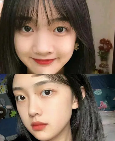 深圳哪個醫生做鼻子比較好