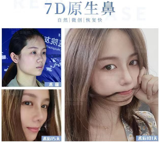 李從從鼻綜合案例