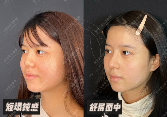 國內修復鼻子最好的專家有哪些？
