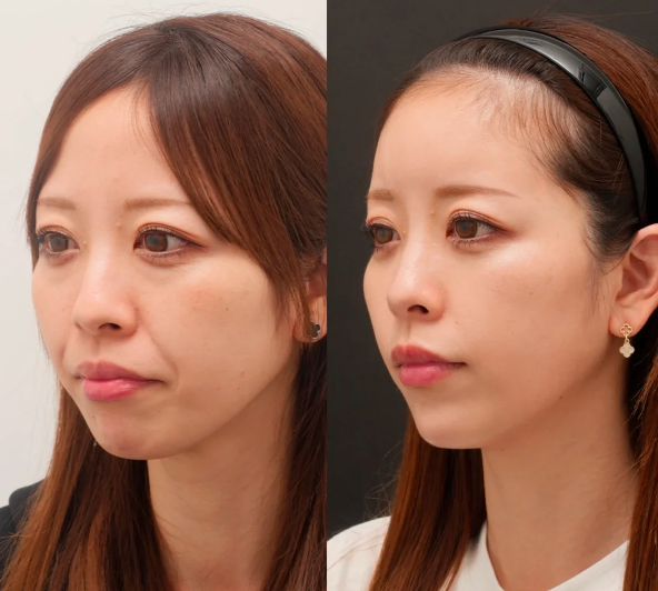 成都畫美何珊珊輕薄提升三件套效果好嗎