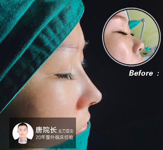唐永豐鼻綜合案例