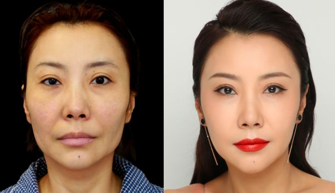 上海九院擅長做面部拉皮的醫(yī)生有哪些？