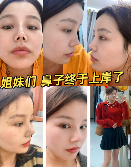 北京鼻修復(fù)醫(yī)生技術(shù)最好是誰