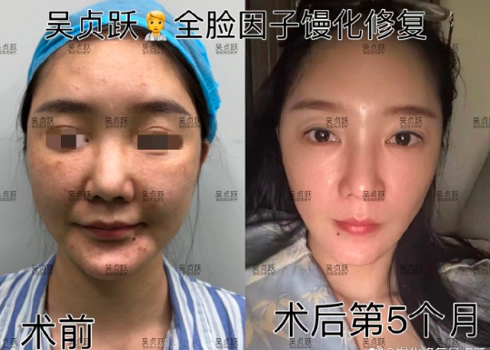 上海吳貞躍做饅化修復怎么樣